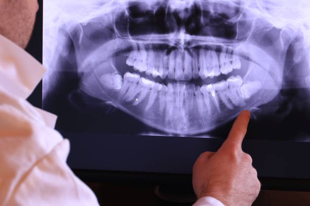 Best Walk-In Emergency Dentist in Sam Rayburn, TX