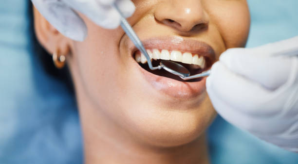 Best Emergency Broken Tooth Repair in Sam Rayburn, TX