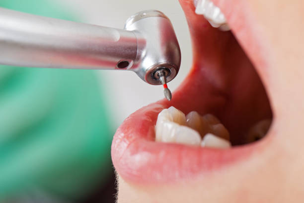 Best Emergency Treatment for Toothache in Sam Rayburn, TX